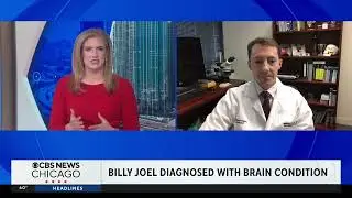 What is hydrocephalus? A neurosurgeon explains Billy Joel's concert tour-canceling diagnosis.