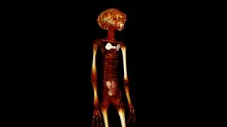(OFFICIAL) ALIEN BODY Scientific Presentation - Mexico's Government Alien Bodies (Spanish/no sound)