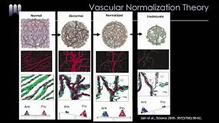 RET16 04   Section XII Neovascular AMD   OCT Angiography in Neovascular AMD Can We Predict Treatment