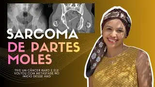 🔴Soft Tissue Sarcoma | My Symptoms | Chemotherapy | Remission 🙌🏻