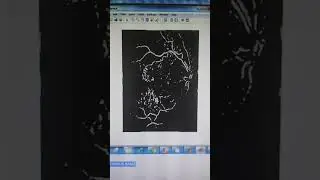 RETINAL BLOOD VESSEL SEGMENTATION FROM FUNDUS IMAGE - MATLAB