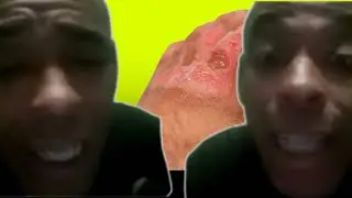 ⚜️🏆Para mi no es ningún prejuicio quitarme la camisa y veas las kemaduras🏆⚜️😬🧟‍♂️