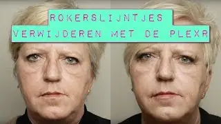 Rokerslijntjes verwijderen met de PlexR | FURROW.NL