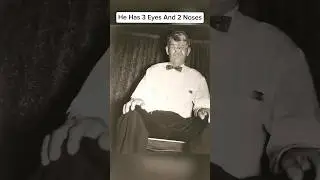 Люди, родившиеся с дополнительными частями тела 🤯