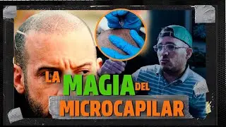 &ldquo;Implantaci&oacute;n Microcapilar: Rub&eacute;n Turbi  en el Podcast Explicado 🎙️✨ Enigma Project EP. 002&rdquo;