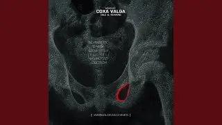 Coxa Valga (Technoyzer Remix)