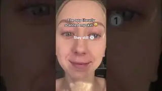 Custom Acne Treatment - Get Your First Kit Free!