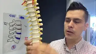 DDD-Degenerative Disc Disease?Chiropractor-Eden Prairie-DrBevanda