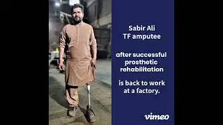 TF Amputee , after a successful rehabilitation at Strides Healthcare