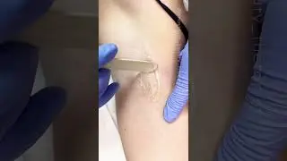 Demonstration of waxing extra short hair with Starsoft hard wax from Starpil