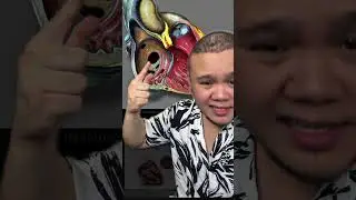 KENAPA SAMPAI KENA GUGURKAN KANDUNGAN? PERNAH DENGAR EDWARD SYNDROME?