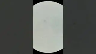 Espermatozoides vs estomago (remaster) #shorts #microscopio