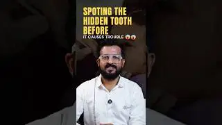 Spotting the hidden tooth before it causes Trouble? |Dr Raed Saed |Orthodontist |Calicut