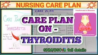 Care Plan On Thyroiditis📚| thyroiditis nursing care plan | ncp on hypothyroidism, hyperthyroidism |