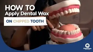 How to apply dental wax on chipped tooth