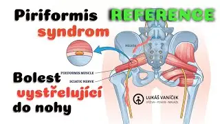 Reference na ře&scaron;en&iacute; bolesti vystřeluj&iacute;c&iacute; do nohy - Piriformis syndrom | Luk&aacute;&scaron; Van&iacute;ček