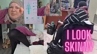 Foodie Beauty Scooter Is Struggling Rolling Down The Hill, The Kity Has A Surgery Date