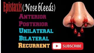 Epistaxis(Nose bleeding) | Types of epistaxis. - #Epistaxis#NoseBleeding#Nosebleeds- #ENT