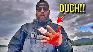 The Worst Fishing Injury I've Ever Sustained! (Northern Pike Demolishes Hand!)