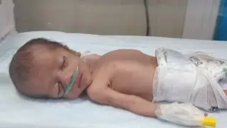 Fragile Preterm Baby in NICU | Oxygen & Incubator Support Journey..