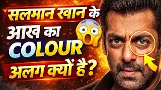 Salman Khan Ki Eyes Me Kya Problem Hai 😱 | Salman Khan Ki Aankhen Alag Alag Kyun Dikhti Hain 