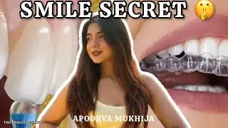 Secret of Apoorva Mukhija smile transformation 🥳| The Braces dentist