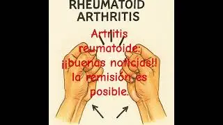 artritis reumatoide:remision= cura recuperacion