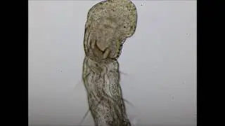 Aeolosoma in action
