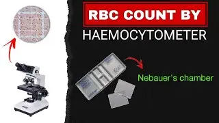 Red Blood Cell Count Test | Total RBC count | Procedure and Calculations
