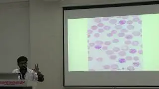 Lecture On Reticulocyte Count: Understanding the Body's RBC Production I MBBS