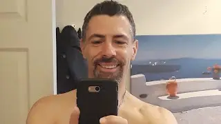 Wearing Dentures #8:  Two week update with a full set of immediate dentures (😁)