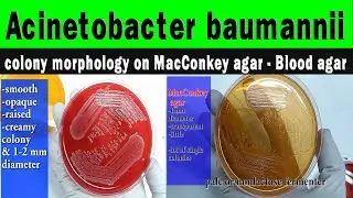 Acinetobacter colony morphology on MacConkey agar-Blood agar, diagnostic features,preventive methods