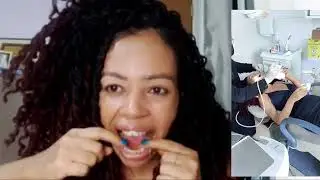 Aparelho móvel ou contenção minha experiência+ tive uma experiência horrível no dentista 