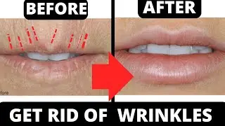 Lift & Tone Your Skin | Facial Cupping for Wrinkles Around the Mouth & Lip Lines