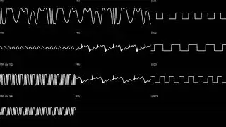 XENON: Mugen no Shitai - Towering Past (YM2608) Oscilloscope View