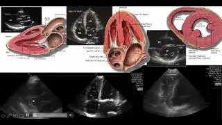 Ultrasound Education in Biochemistry Wet Beriberi