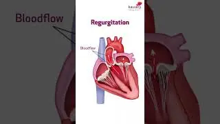How a Damaged Heart Valve Can Affect Your Breathing? | Kauvery Hospital Chennai | Tamil Shorts