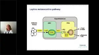 Genetic Obesity Disorders caused by Leptin melanocortin Pathway Defects