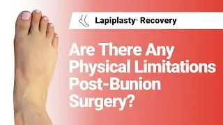 Are There Any Physical Limitations Post-Bunion Surgery? | Lapiplasty&reg; Recovery