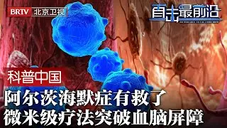 攻破“阿兹海默症”难题，中国微米级疗法问世，突破血脑屏障，欧美药企研发宣告失败【科普中国直击最前沿】