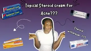 Are Topical Steroid Creams Actually Bad for Treating Acne???