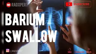 🤔How To Do  X-ray Barium Swallow||Barium Swallow #xray#radxpert#bariumswallow#ct#radition#viral