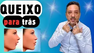 Queixo para Trás: Descubra o Melhor Tratamento!
