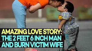 The AMAZING Love Story of the 2ft 6in Man and His Burns Victim Wife