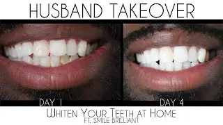 How to Whiten Your Teeth At Home | Smile Brilliant