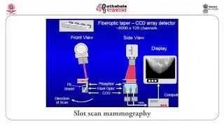 Mammography
