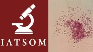 Candida under microscope