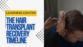Day 1 to 1 Year: The Hair Transplant Recovery Timeline They Don&rsquo;t Tell You About