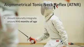 How do retained primitive reflexes affect my child? PART 2