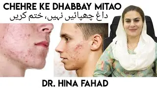 Acne ke nishan kaise khatam karein? صاف جلد کا راز؟ | acne marks ka ilaj | dark spots on face